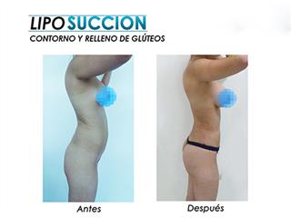 Dr. Hernán Perez Montesinos, Cirugía Plástica y Reconstructiva.